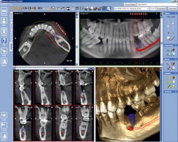 xray2